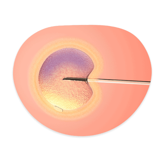 IVF In-Vitro Fertilization